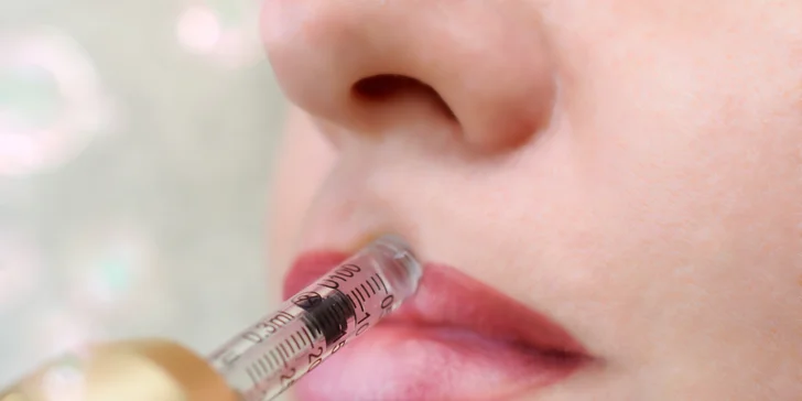 Hydratácia alebo zvýraznenie pier kyselinou hyalurónovou