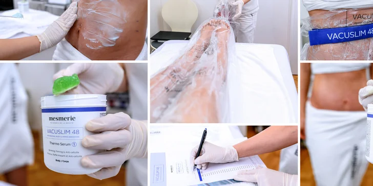Zoštíhľujúce a anticelulitídne ošetrenie Vacuslim 48 v salóne Somedea, v ponuke aj permanentka