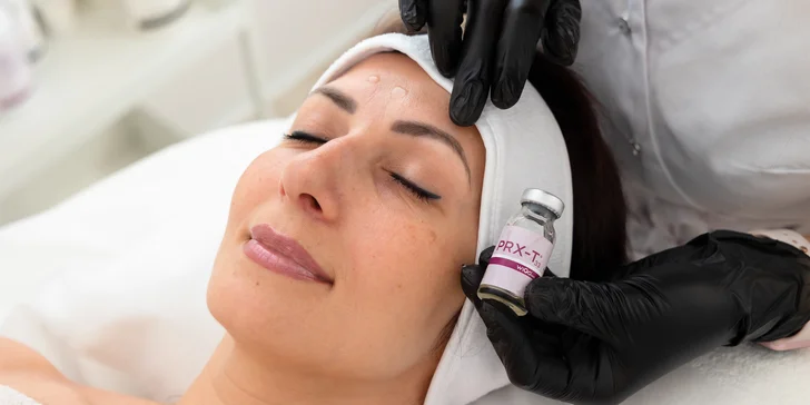 Mezoterapia tváre s dermapenom, liftingové ošetrenie s rádiofrekvenciou alebo PRX-T33