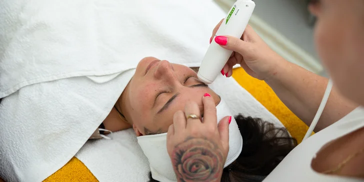Contouring tváre, lifting obočia či dekoltu prístrojom MicrosonPen