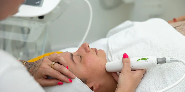 Contouring tváre, lifting obočia či dekoltu prístrojom MicrosonPen