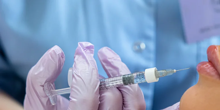 Výplň, hydratácia či korekcia pier alebo odstránenie vrások okolo úst pomocou kyseliny hyalurónovej v ESTE MED
