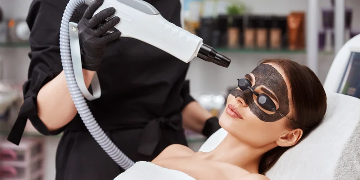 Carbonpeeling - unikátny peeling s laserom pre hladkú a žiarivú pleť