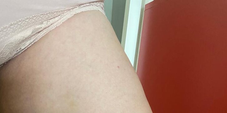 Anticelulitídna masáž valčekmi v Diva Beauty na boky, stehná, brucho aj zadok