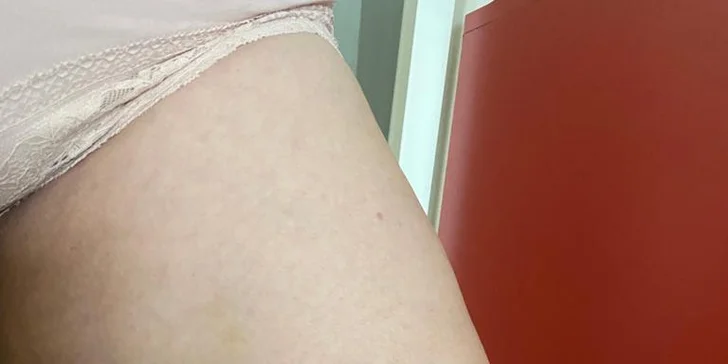 Anticelulitídna masáž valčekmi v Diva Beauty na boky, stehná, brucho aj zadok