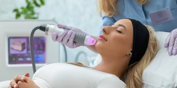 Vivace: Mikroihličková rádiofrekvencia s carbon peelingom pre aknóznu aj starnúcu pleť