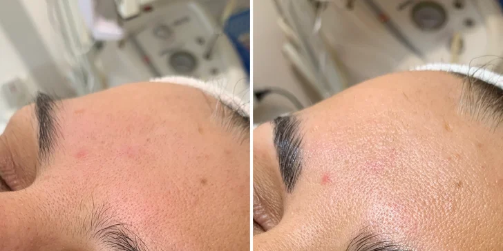 Kozmetické služby: Lash lift mihalníc, laminácia obočia, úprava a farbenie obočia hennou, ultrazvukové čistenie alebo kompletné ošetrenie pleti