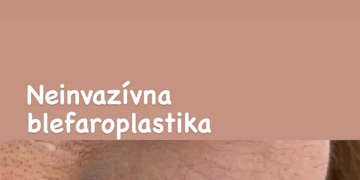 Ošetrenie plazmaperom: Odstránenie vrások a korekcia viečok