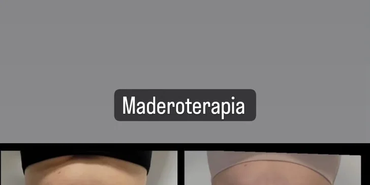 Maderoterapia: Masáž drevenými valčekmi proti celulitíde