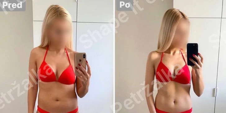 Pohodlné chudnutie a formovanie postavy: InfraShape Horizontal alebo Duo Shaper
