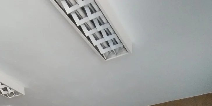 Vyhladenie vrások, nadvihnutie viečok a Mikroihličková mezoterapia pre krásnu pleť