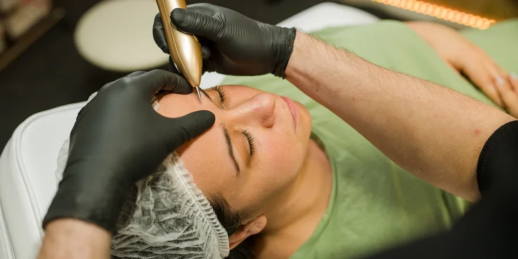 Vyhladenie vrások, nadvihnutie viečok a Mikroihličková mezoterapia pre krásnu pleť