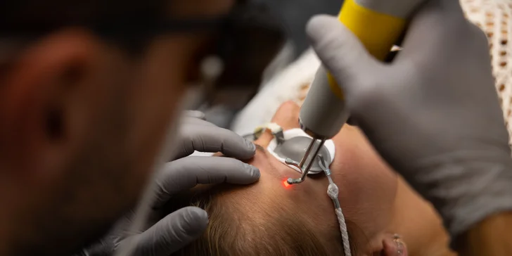 Odstránenie permanentného make-upu obočia pomocou lasera