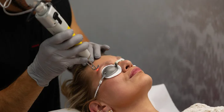 Odstránenie permanentného make-upu obočia pomocou lasera