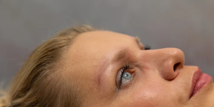 Odstránenie permanentného make-upu obočia pomocou lasera
