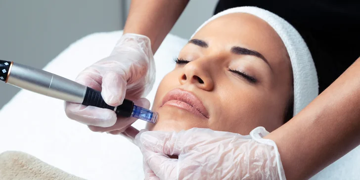 Kozmetické ošetrenia v salóne Stella: Mikrodermabrázia, chemický peeling, ihličková mezoterapia a iné