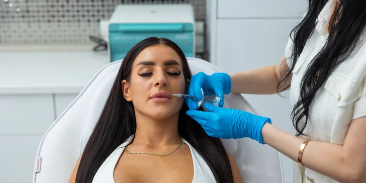 Russian lips, výplň a hydratácia pier kyselinou hyalurónovou