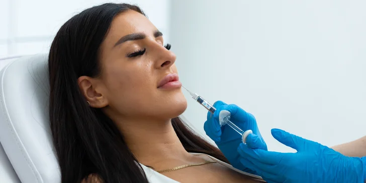 Russian lips, výplň a hydratácia pier kyselinou hyalurónovou