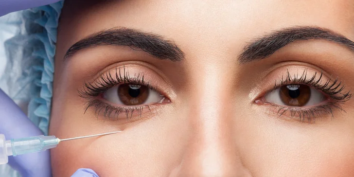 Omladenie očného okolia pomocou injekčnej aplikácie peptidu Lumi Eyes