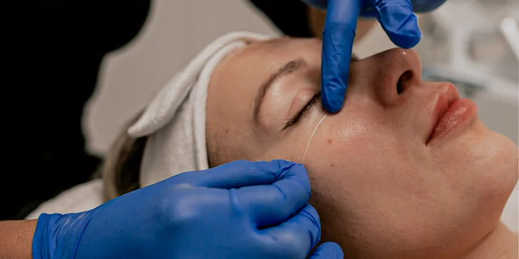 Kolagénové ošetrenie pleti s kolagénovými niťami alebo masáž tváre v Anzu Cosmetics