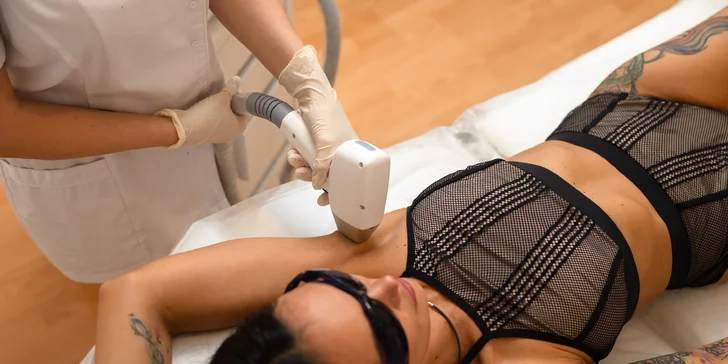 Epilácia rôznych partií pomocou diódového lasera