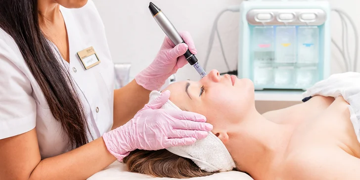 Esteľ by Dr. Žaneta: Lekársky chemický peeling alebo potlačenie pigmentácie mezoterapiou