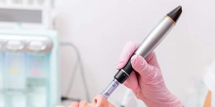 Esteľ by Dr. Žaneta: Lekársky chemický peeling alebo potlačenie pigmentácie mezoterapiou