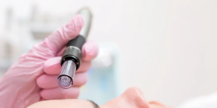 Esteľ by Dr. Žaneta: Lekársky chemický peeling alebo potlačenie pigmentácie mezoterapiou