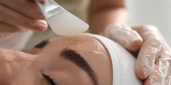 Esteľ by Dr. Žaneta: Lekársky chemický peeling alebo potlačenie pigmentácie mezoterapiou