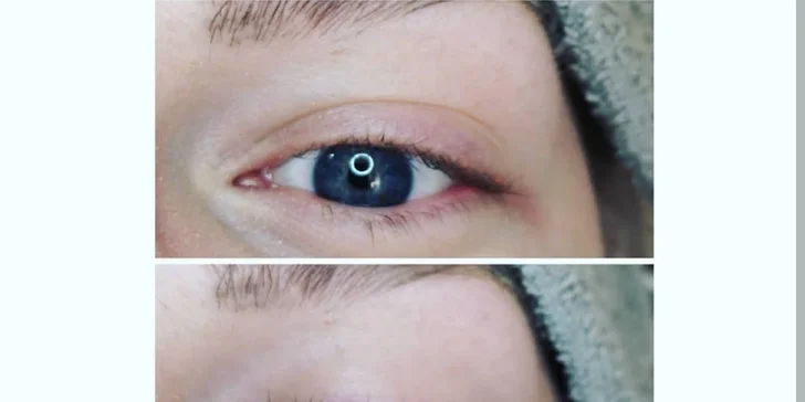 Predĺženie či lash lift mihalníc aj s lamináciou obočia