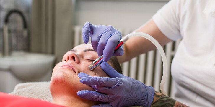 Kompletné ošetrenie pleti s masážou tváre, luxusné ošetrenie s mikrodermabráziou alebo microneedling