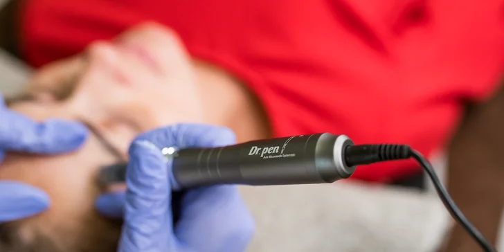 Kompletné ošetrenie pleti s masážou tváre, luxusné ošetrenie s mikrodermabráziou alebo microneedling