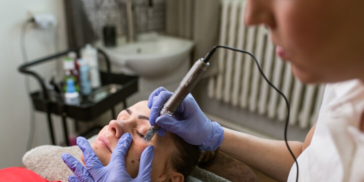 Kompletné ošetrenie pleti s masážou tváre, luxusné ošetrenie s mikrodermabráziou alebo microneedling