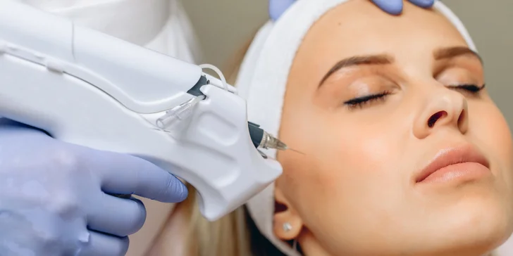 Jemný lifting aj prevencia proti vráskam: Mezoterapia pleti Vital Injectorom