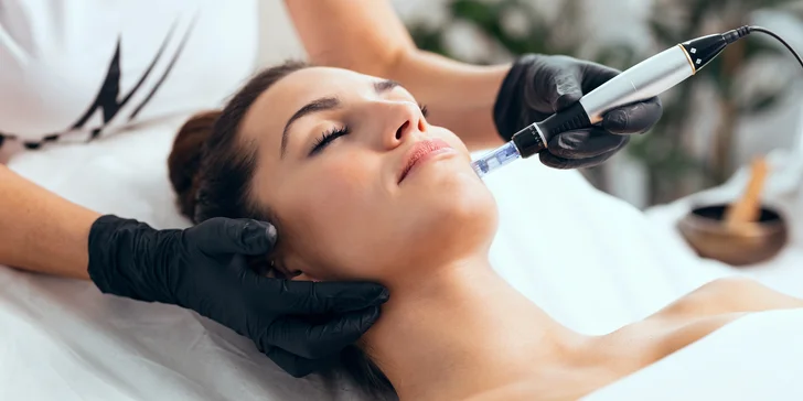 Mezoterapia tváre či vlasov alebo microneedling