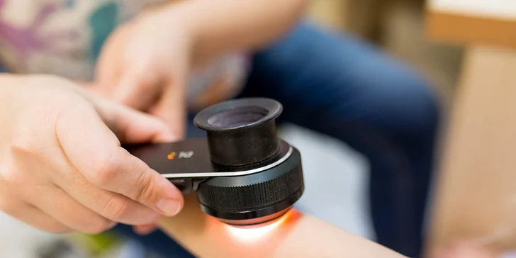 Vyšetrenie znamienok digitálnym dermatoskopom alebo ich odstránenie elektrokauterom