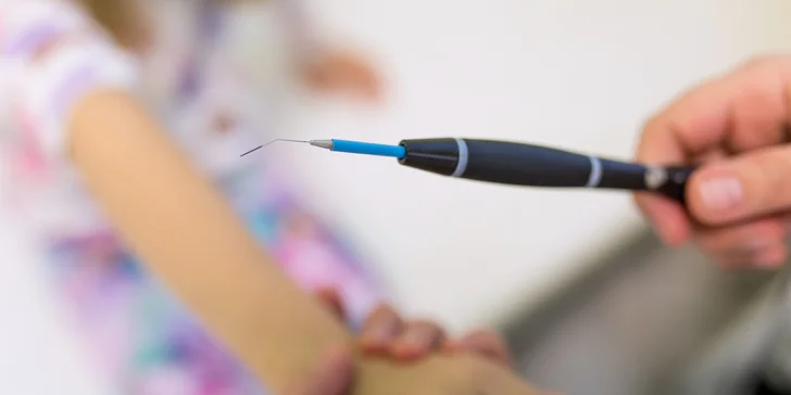 Vyšetrenie znamienok digitálnym dermatoskopom alebo ich odstránenie elektrokauterom