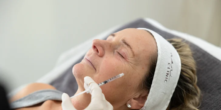 Odstránenie mimických vrások pomocou botulotoxínu na čele, v okolí očí a v medziobočí