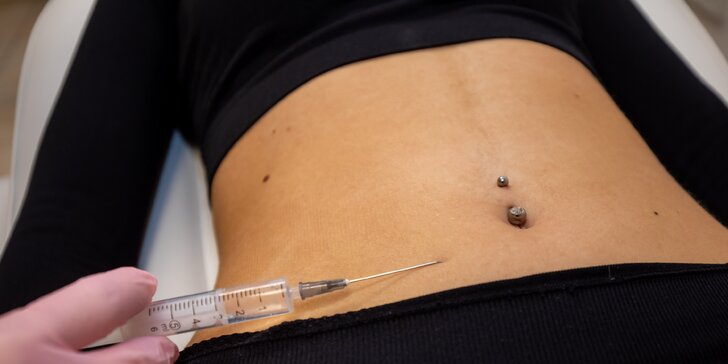 Odstránenie tuku pomocou injekčnej lipolýzy v Neuroderm