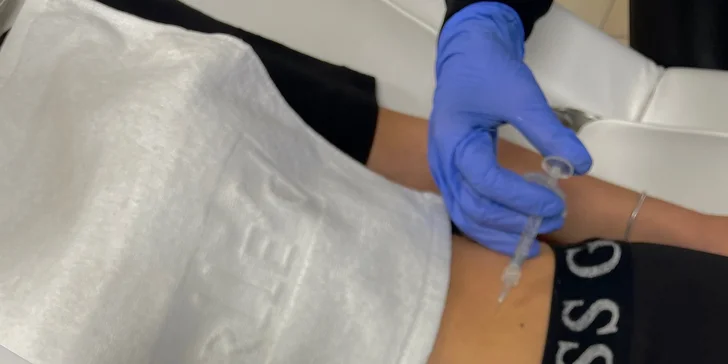 Odstránenie tuku pomocou injekčnej lipolýzy v Neuroderm