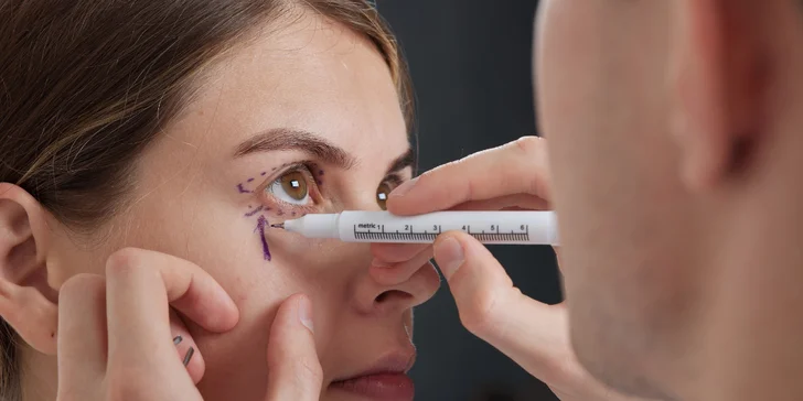 Lifting čela a viečok: Operácia horných viečok alebo Direct browlift s efektom blefaroplastiky