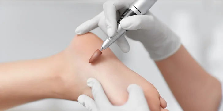 Medicínska kombinovaná pedikúra v útulnom štúdiu Medical Foot Care