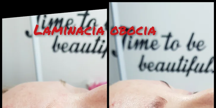 Lash Lift & Botox, laminácia obočia alebo umelé mihalnice 1D až 3D