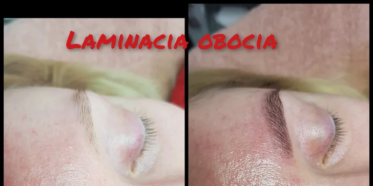 Lash Lift & Botox, laminácia obočia alebo umelé mihalnice 1D až 3D