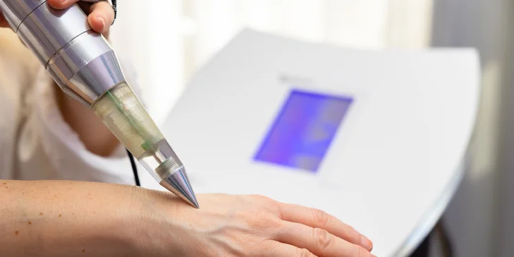 New age plasma care: Odstránenie vrások na tvári, jaziev alebo strií