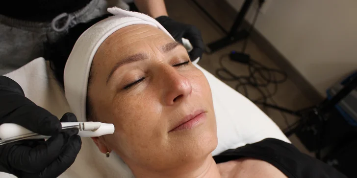 Omladzujúca dermomasáž alebo mechanický peeling prístrojovou oxybráziou
