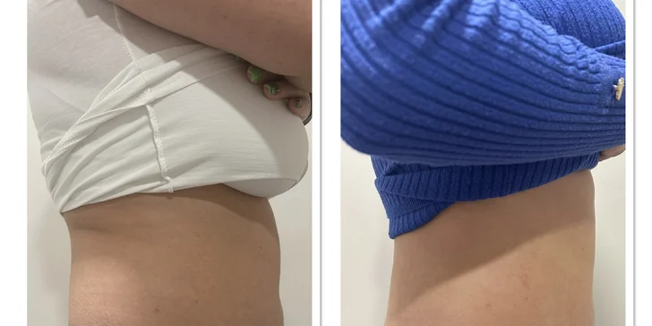 Vyformujte svoje telo a cíťte sa sebavedomejšie vo VERSI beauty lounge v Piešťanoch
