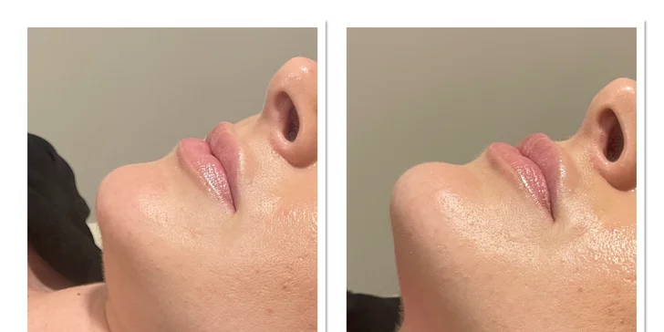 Vyformujte svoje telo a cíťte sa sebavedomejšie vo VERSI beauty lounge v Piešťanoch