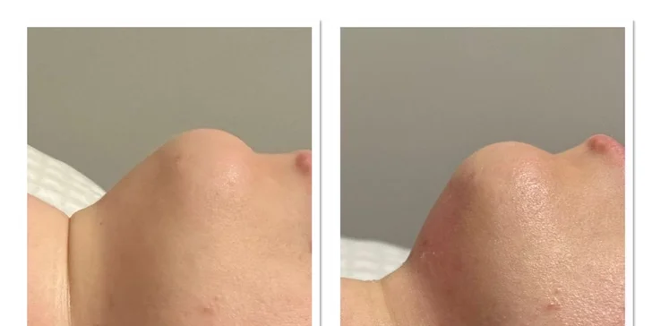 Vyformujte svoje telo a cíťte sa sebavedomejšie vo VERSI beauty lounge v Piešťanoch