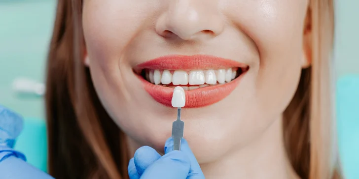 Dentálna hygiena s pieskovaním alebo bielenie zubov